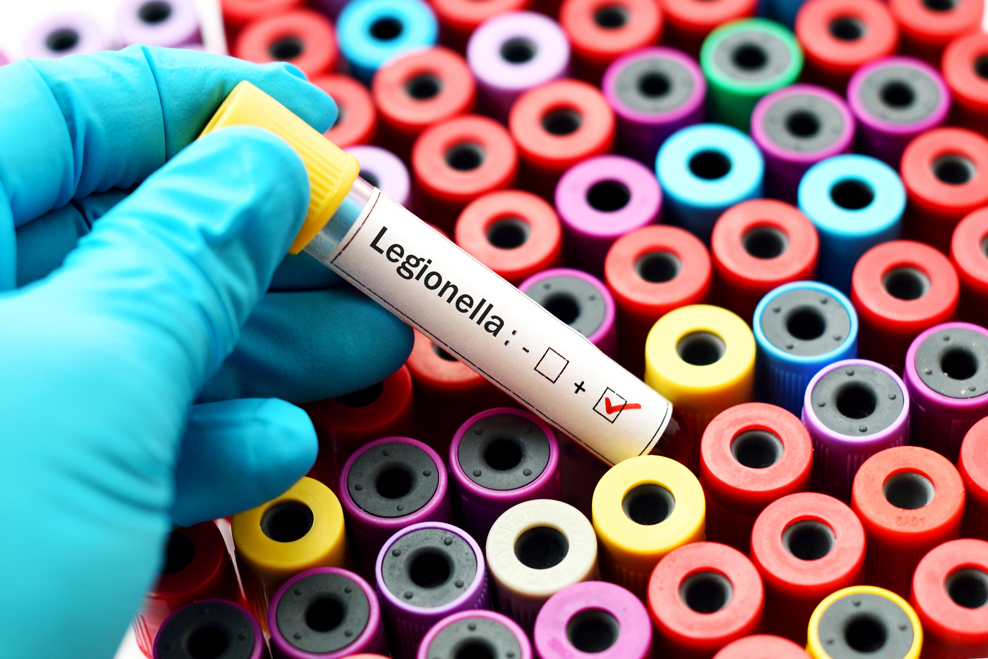 Read more about the article Legionella w powiecie pyrzyckim